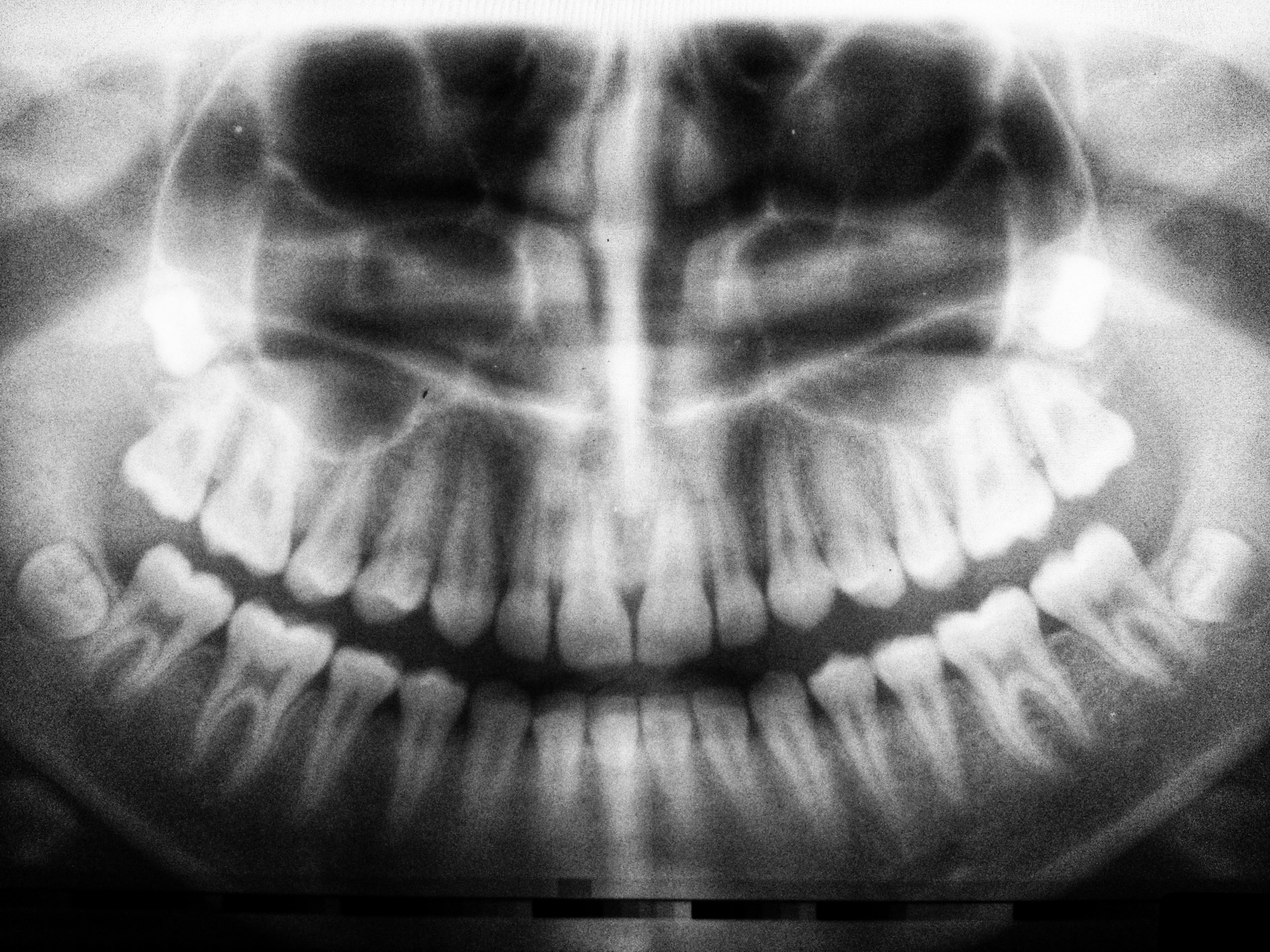 My Spiritual Body as&nbsp;Teeth